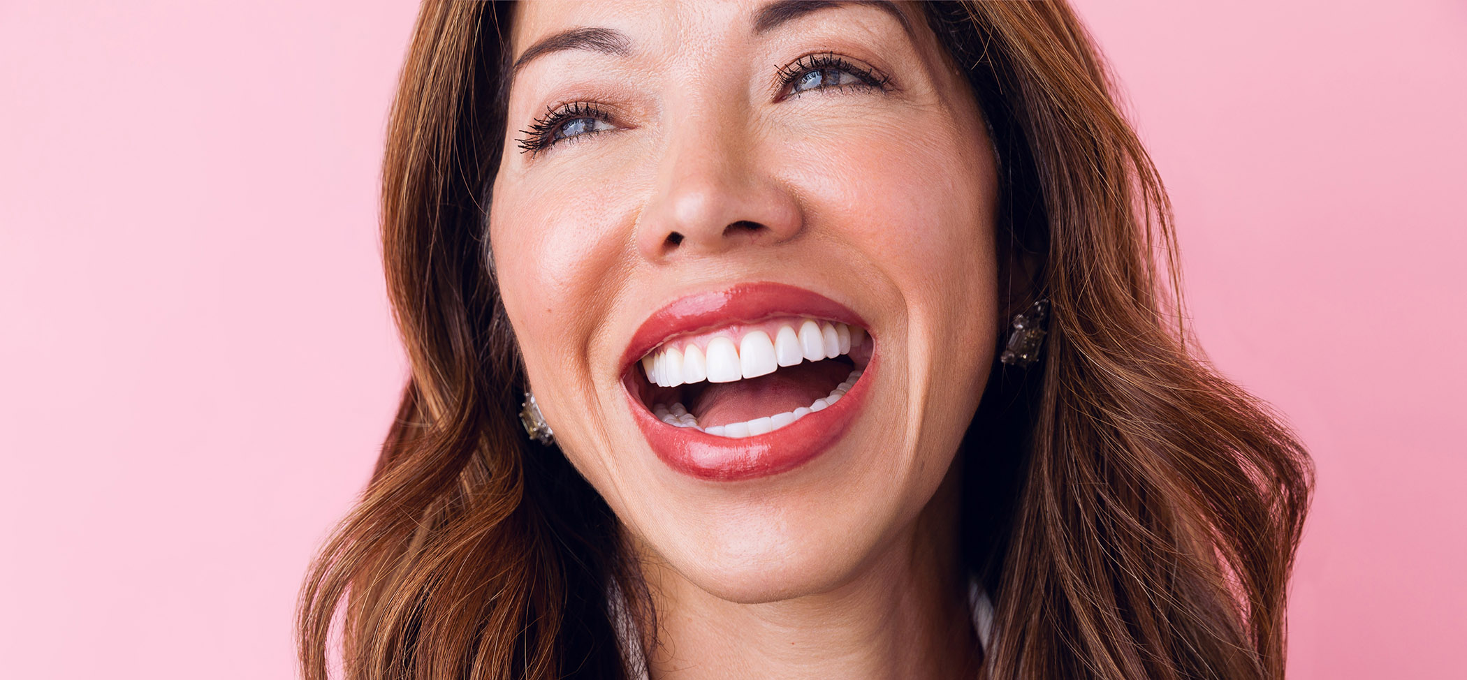 Top Big Header - Smile Makeovers
