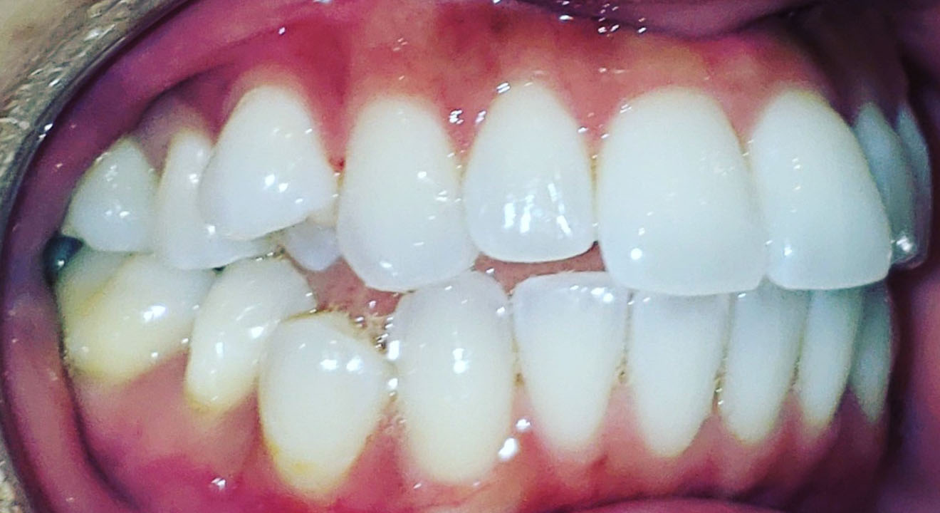 Before